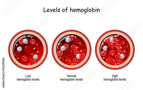 hemoglobin level. Cross section of blood vessel with red blood cells