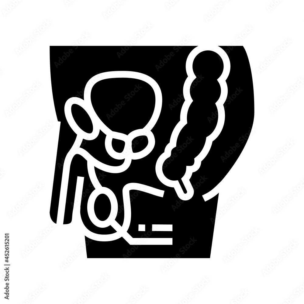 testes endocrinology glyph icon vector. testes endocrinology sign. isolated contour symbol black illustration testes endocrinology glyph icon vector. testes endocrinology sign. isolated contour symbol black illustration