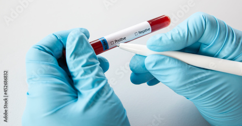 laboratory assistant marks a positive blood test by red check mark