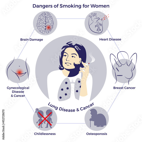 Dangers of smoking for women. Illness risk. Stop smoking. World no tobacco day. Air pollution. Infographic. Vector illustration. Healthcare poster, placard or banner template.