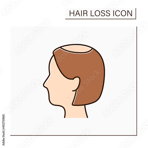 Hair loss color icon. Woman loses hair. Widening of midline part and noticeably decreased hair volume in vertex. Alopecia concept. Isolated vector illustration