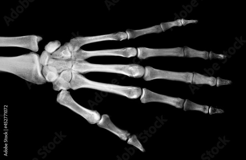 human palm bones on black background