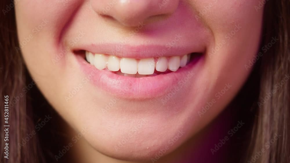 Wide female smile, white teeth close-up. young woman smiling mouth portrait, teenager showing her teeth closeup. Dentistry and orthodontics concept. Wide female smile, white teeth close-up. young woman smiling mouth portrait, teenager showing her teeth closeup. Dentistry and orthodontics concept.