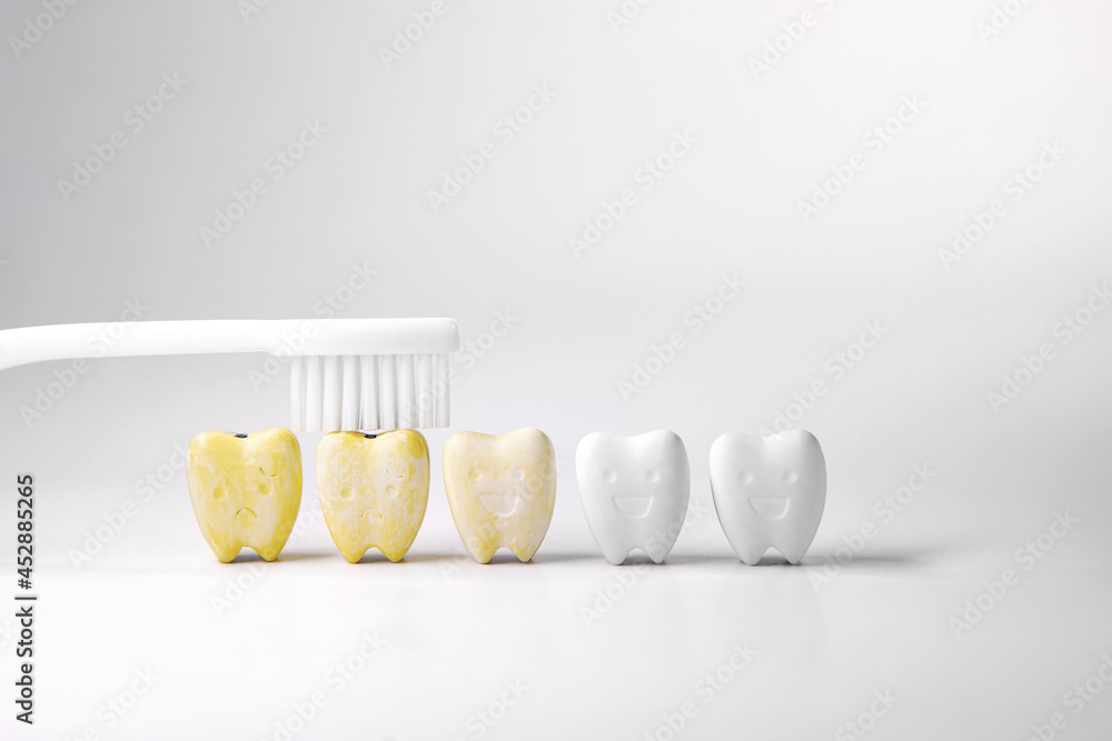 Wall Mural Discoloration teeth, Cure yellow teeth This can be done by starting with oral an