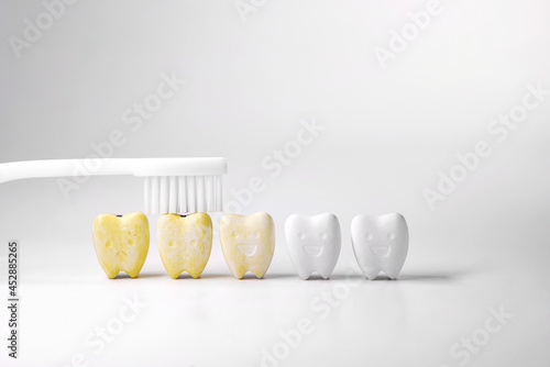 Discoloration teeth, Cure yellow teeth This can be done by starting with oral and dental care cleaning By brushing your teeth properly at least twice a day or brushing your teeth after every meal 