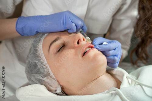 A doctor cosmetologist performs a lip contouring procedure for a young woman in a beauty parlor using the Russian lips technique. Lip augmentation. Botulinum therapy. Botox. Cosmetology and skin care.