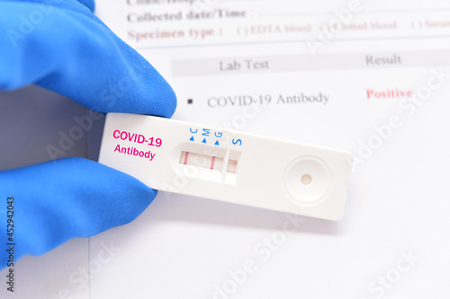 COVID-19 antibody positive test result by using rapid test kit for COVID-19 antibody  photo