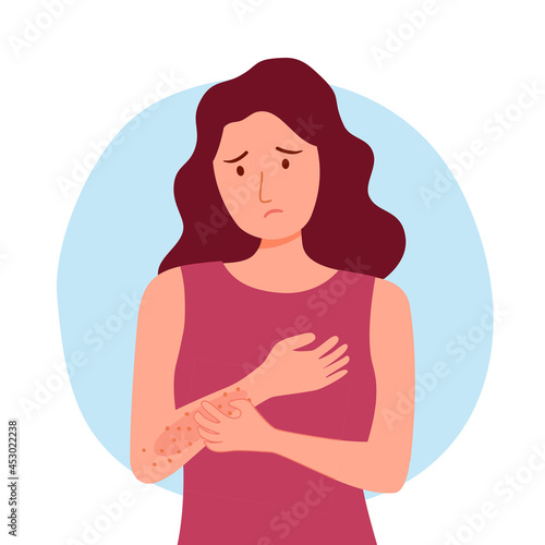 Young woman scratching arm. Female suffering from strong allergy skin itchy symptom in flat design. Red rash skin irritation.	