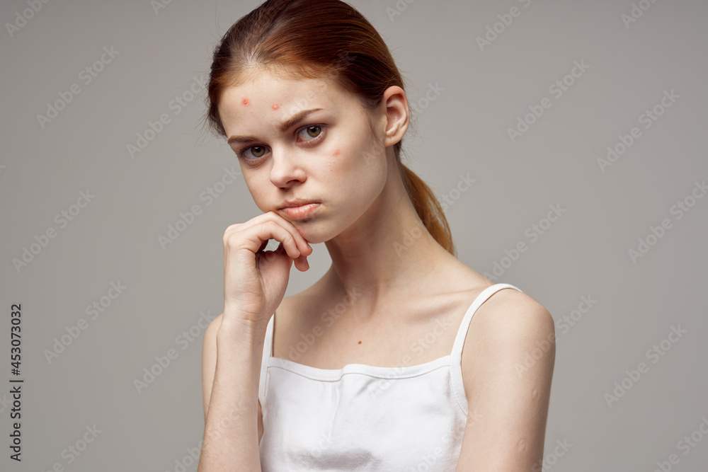 beautiful woman with pimples on the face hygiene isolated background beautiful woman with pimples on the face hygiene isolated background