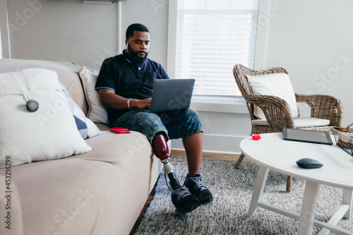 Black man with prosthetic leg working from home on laptop