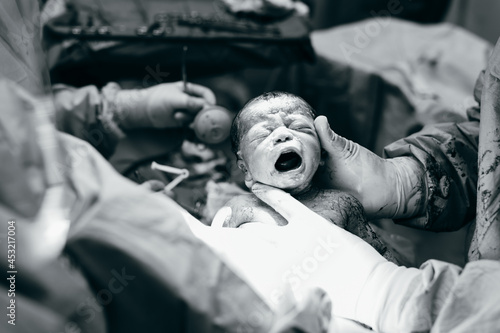 Black newborn first cry after being born photo