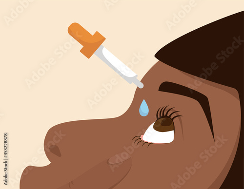 Person applying eyedrops with pipette. Medical treatment, eyewash, irritaion. Can be used for topics like allergy, glaucoma, dryness or inflammation