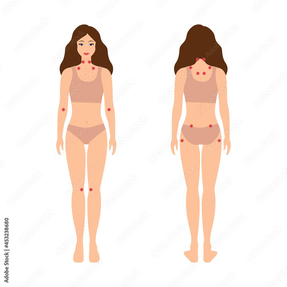 Fibromyalgia trigger points, tender point map. Fibromyalgia trigger points, tender point map.
