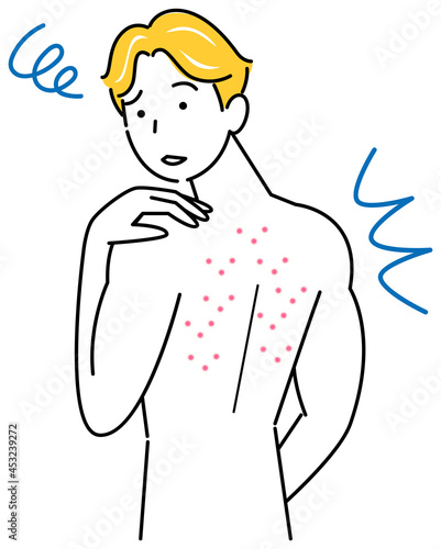 スキンケア 背中にポツポツ（吹き出物・ニキビ）が出来て悲しんでいる可愛い男性 イラスト シンプル ベクター