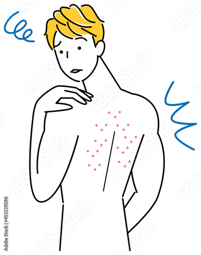 スキンケア 背中にポツポツ（吹き出物・ニキビ）が出来て悲しんでいる可愛い男性 イラスト シンプル ベクター