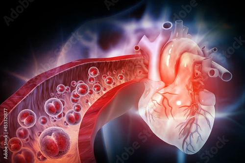 3D illustration of Human cells on artery photo