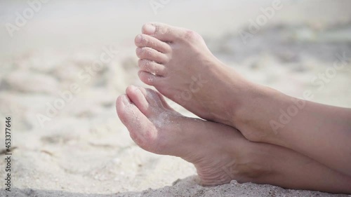 Hallux valgus on female legs close up beach sand. Foot joint deformity. Health care and medicine problem with human body. Vacation Traveling Halluxvalgus photo