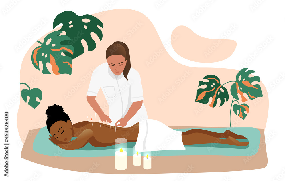 Obraz premium professional acupuncture for an African-American girl. Vector illustration, a healing procedure
