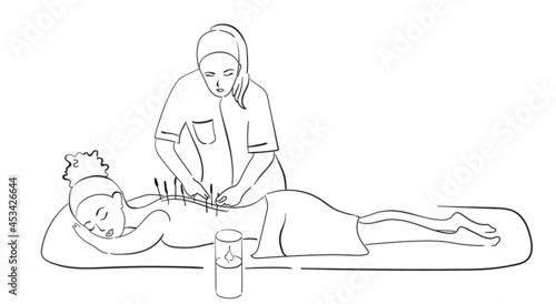 professional acupuncture for an African-American girl. black outline of a vector illustration, a healing procedure