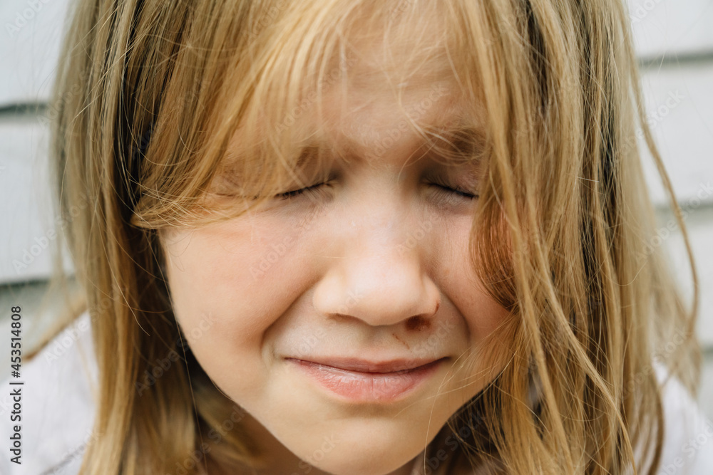 Portrait girl with an abrasion under her eye. child abuse. wounds and abrasions Portrait girl with an abrasion under her eye. child abuse. wounds and abrasions