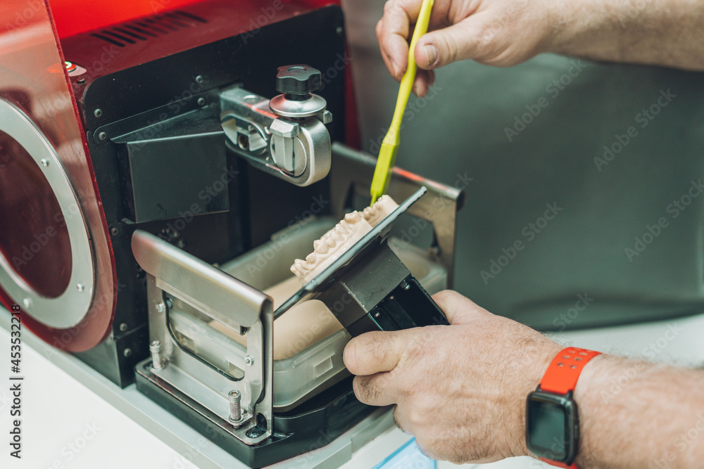 Man's hand collecting the excess of resin from a 3D dental printer in a dental laboratory Man's hand collecting the excess of resin from a 3D dental printer in a dental laboratory