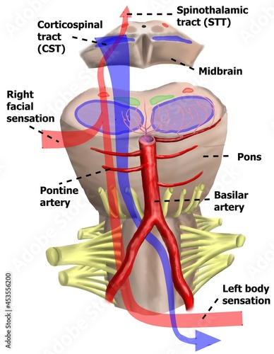 The illustration shown the pathways of spinothalamic tract and corticospinal tract. photo