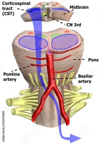 The pathway of the third cranial nerve and corticospinal tract.  photo