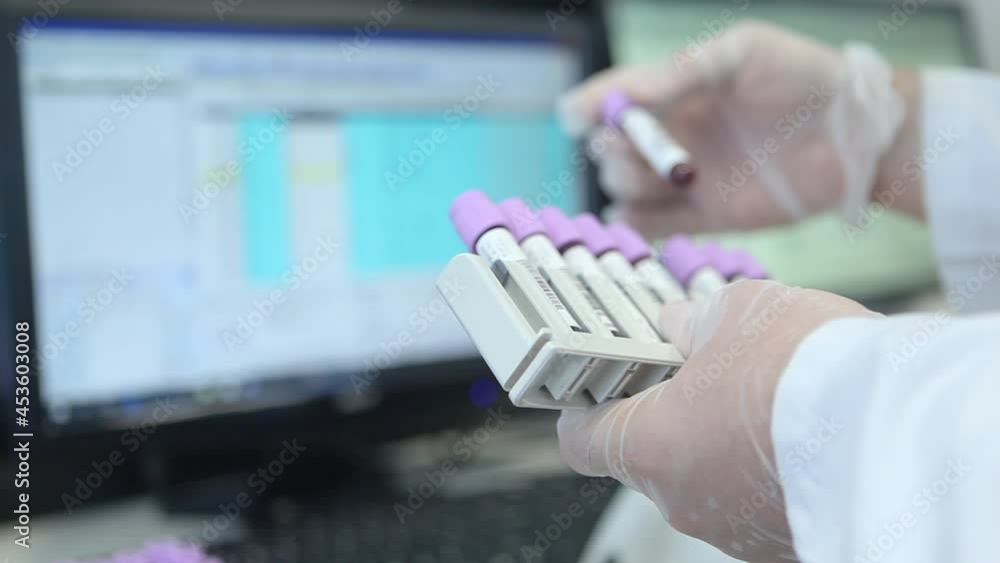 laboratory blood tube. Reading QR codes in the laboratory. blood tube. Blood test. Stock Video