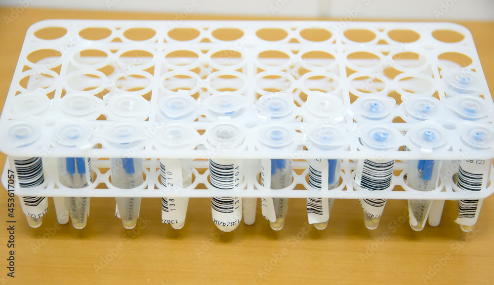 Eppendorf tubes with Coronavirus (COVID 19) biomaterial with barcodes in white test tube rack on