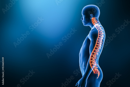 Lordosis pathology with man model from lateral view 3D rendering illustration with copy space. Human anatomy, spinal deformity, curvature of the spine, backbone pathology, medical concepts.