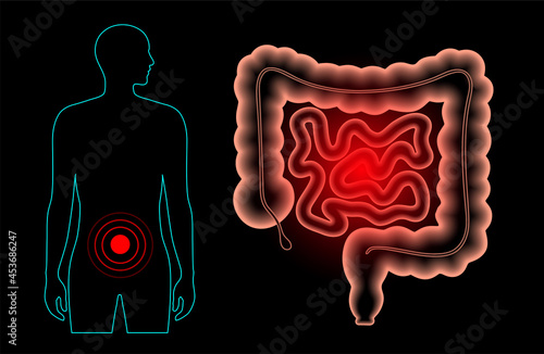 Intestine pain concept