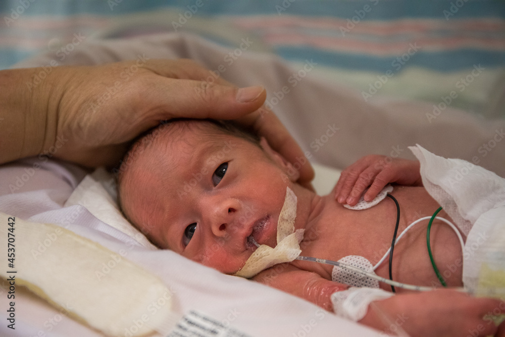Premature newborn baby in incubator - obrazy, fototapety, plakaty 