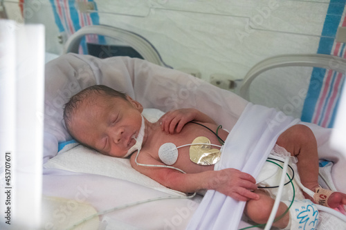 Premature newborn baby in incubator