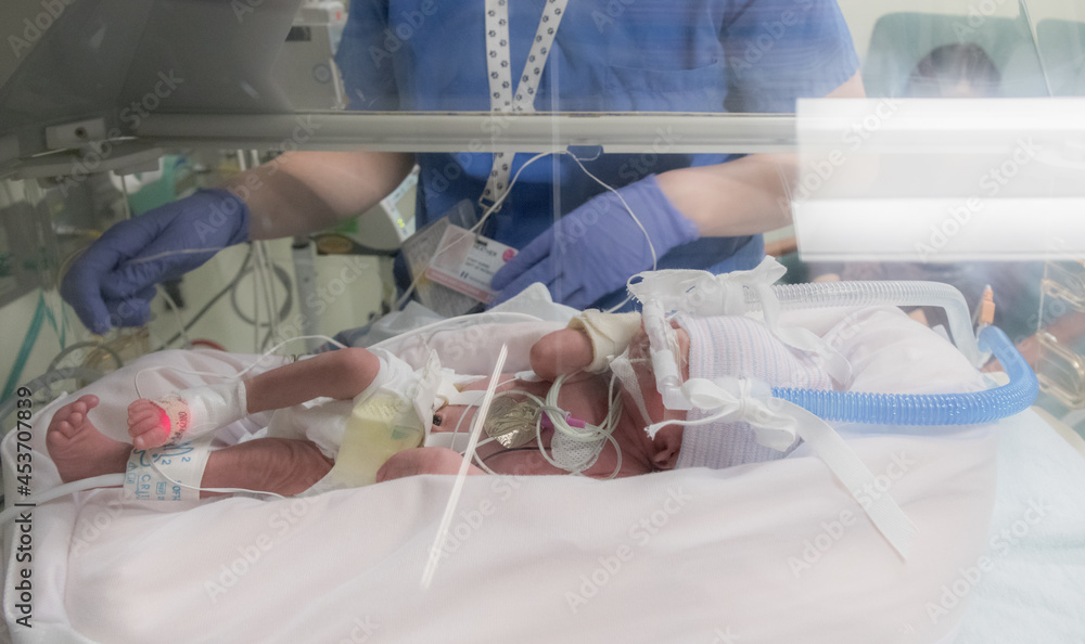 Fototapeta premium Nurse caring Premature newborn baby in incubator (Soft)
