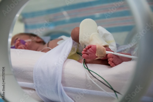 Foot of premature newborn baby in incubator photo