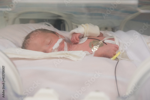 Premature newborn baby in incubator (Soft)