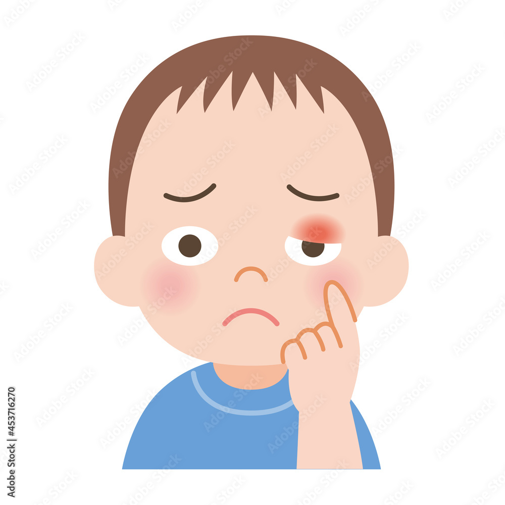 まぶたが腫れた男の子 まぶたが腫れた男の子