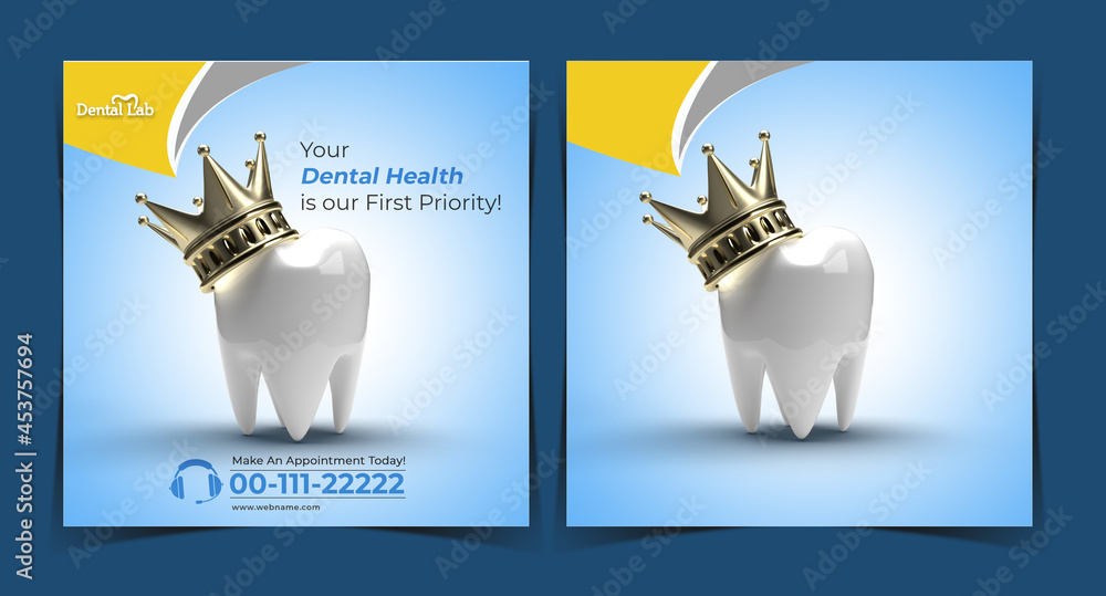 Tooth with Golden Crown Dental Implants Surgery Concept Instagram Post