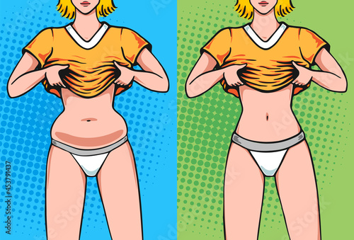 Belly fat woman before and after. Weight loss in waist side by side concept illustration in pop art comics style