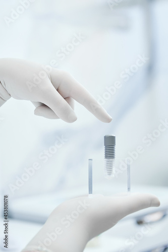 Dentist implantologist showing dental implant technology 