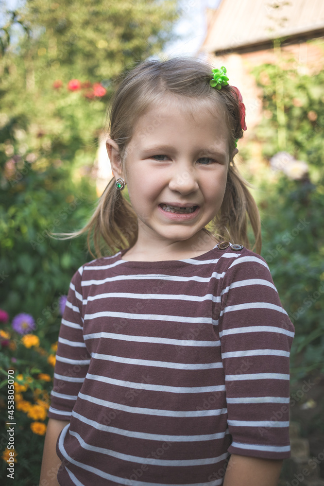 Child with a dental orthodontic device and without one tooth Child with a dental orthodontic device and without one tooth