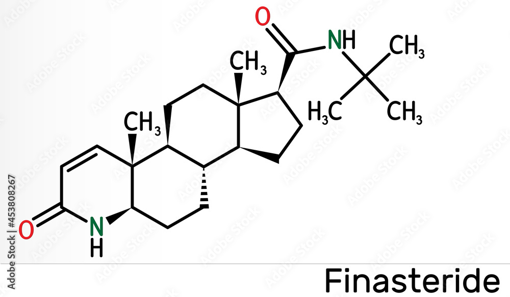Finasteride molecule. It is used to treat symptoms of benign prostatic hypertrophy and male pattern baldness. Skeletal chemical formula Finasteride molecule. It is used to treat symptoms of benign prostatic hypertrophy and male pattern baldness. Skeletal chemical formula