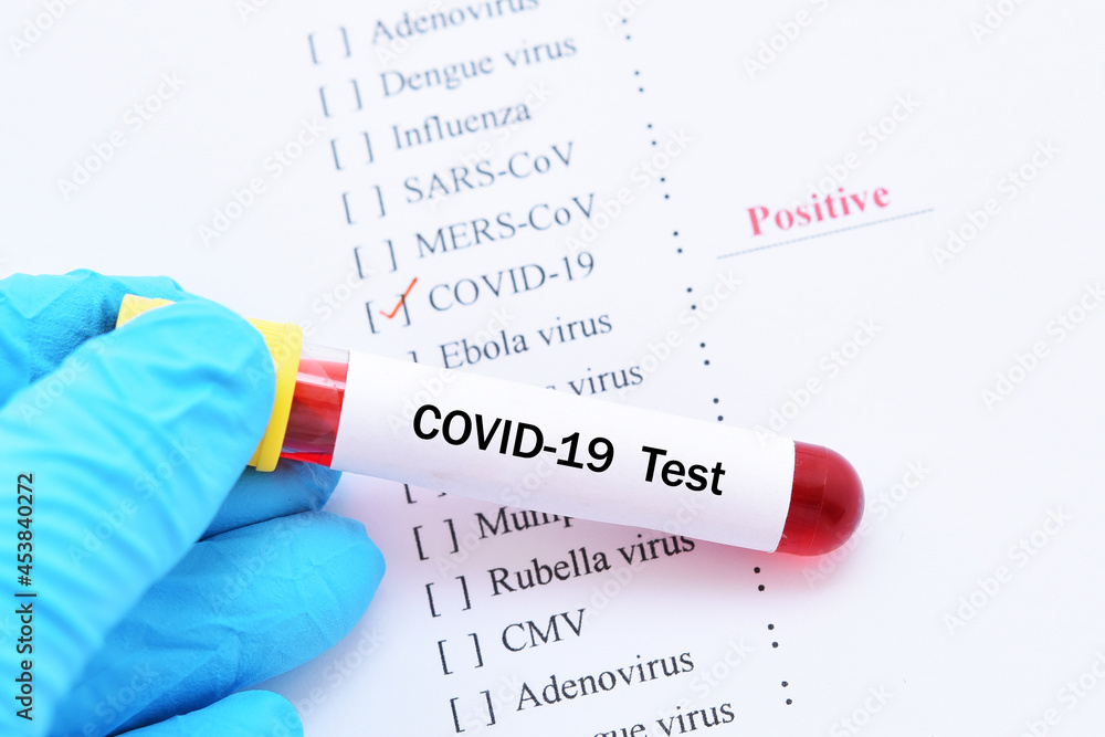 Obraz premium Laboratory report of COVID-19 test, the result showed positive 