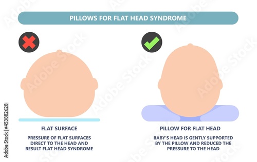 craniosynostosis helmet pillow flat head autism brain skull bone deformity baby infant child newborn defect birth anterior Metopic Born genes genetic position sleep shape deformation tummy time 