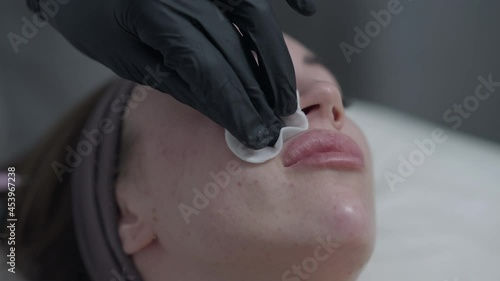 Close-up hands in black gloves injecting rejuvenating beauty filler in face of slim young Caucasian woman. Professional expert using syringe for botox hyaluronic acid injection in beauty parlor photo