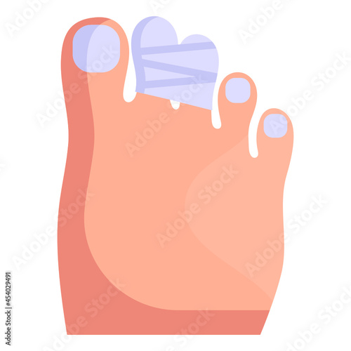Sprain 