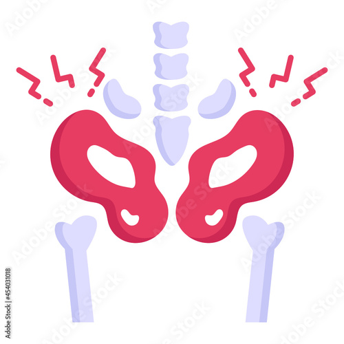Pelvic Fracture 

