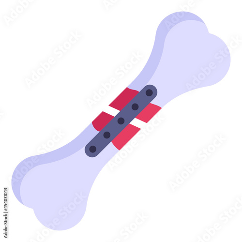 bone splint

