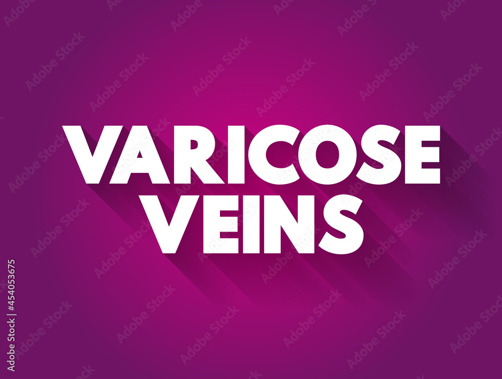 Varicose Veins text quote, concept background Varicose Veins text quote, concept background