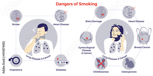 Dangers of smoking for men and women. Illness risk. Stop smoking. World no tobacco day. Air pollution. Infographic. Vector illustration. Healthcare poster, placard or banner template.